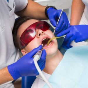 Medi-Cal root canal treatment La Jolla CA — affordable dentist who accepts Medi-Cal near La Jolla performing root canal on patient